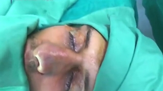 فیلم واقعی جراحی زیبایی بینی