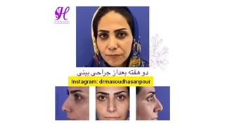 معیارهای انتخاب بهترین جراح بینی در سال ۱۴۰۰