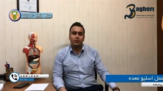 کاهش وزن بعد از جراحی معده