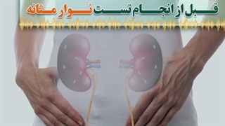 نکات قبل از تست نوار مثانه