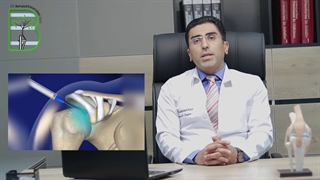 ساییدگی مفصل زانو