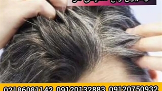 قوی ترین لوسیون رفع سفیدی مو/۰۹۱۲۰۷۵۰۹۳۲/لوسیون رفع سفیدی مو