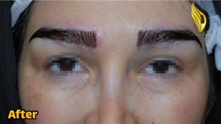 ✅ کاشت ابروی دائمی،قبل و بعد از کاشت