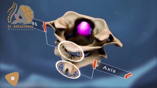 آناتومى ستون فقرات گردن