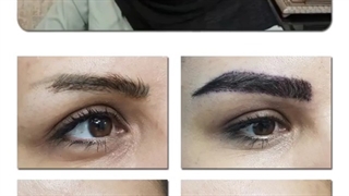 قبل و بعد کاشت ابرو