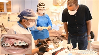 الکترو کوتر.متخصص ارتودنسی تهران.دکترعلیرضاخدیوی