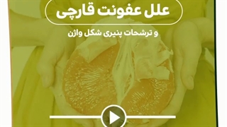 علل عفونت قارچی