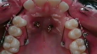 ارتودنسی دندان زیبایی