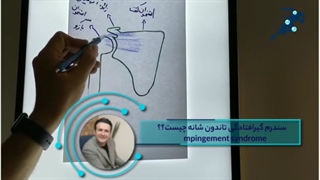 سندروم گیر افتادگی تاندون شانه چیست؟