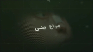 تزریق فیلر یا چربی به بینی