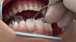 زیبایی دندان