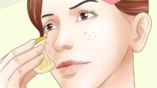 توضیحات دکتر علیزاده در خصوص لکه های قهوه ای پوست جراحی فک