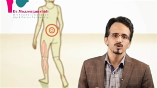 مرالژیا پارستتیکا، سوزن سوزن شدن ناحیه خارجی ران