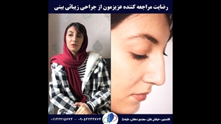 رضایت مراجعه کننده عزیزمون از جراحی بینی