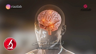 مالتیپل اسکلروز ، MS چیست , ام اس چیست ؟ علائم ام اس