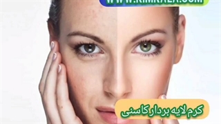 بهترین کرم لایه بردار پوست/۰۹۱۲۰۷۵۰۹۳۲/کرم لایه بردار کاسنی