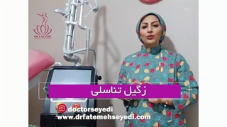 زگیل تناسلی