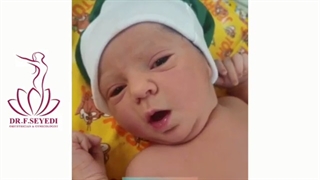 فیلم کامل زایمان سزارین در 41 هفتگی