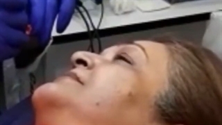 میکروپیگمنتیشن پزشکی لب