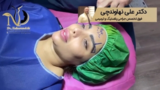فیلم واقعی لیفت ابرو