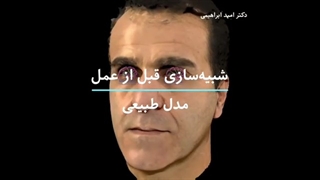 عمل بینی با سرجیکال گاید | دکتر ابراهیمی