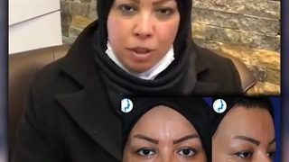 رضایت بیمار چهار ماه بعد از جراحی زیبایی بینی | متخصص گوش و حلق و بینی | دکتر محمد گلی