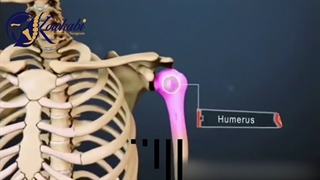 اطلاعاتی مفید درباره آرتروز شانه