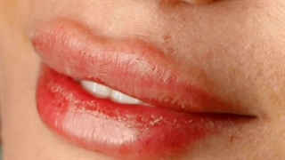 فیلم تزریق ژل لب روسی