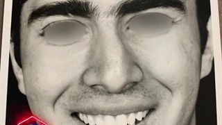 عمل زیبایی بینی مردانه