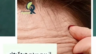 بوتاکس چه کاربردهای دارد؟ عصب‌کشی