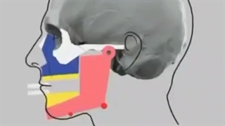 از دست دادن دندان و تحلیل فک | کلینیک تخصصی دندانپزشکی کانسپتا