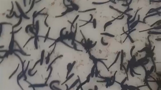 فروش ویژه زالوی طبی کاملا بهداشتی و قرنطینه شده