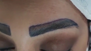 کاشت ابرو بعد از دو هفته | کلینیک ابروان