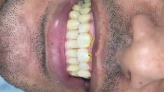 زیبایی دندان