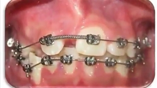 ارتودنسی دندان مشهد