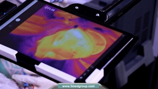 رفع آکنه اسکارها و لیفتینگ و جوانسازی پوست با دستگاه پزشکی  Aphrodite