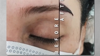 نمونه ای از کاشت ابرو
