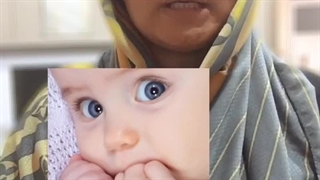 افت شنوایی کودکان