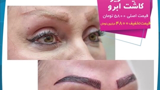 تخفیف ویژه کاشت ابروی طبیعی, تزریق ژل لب , تزریق چربی ,لیفت بینی اینسایزینگ