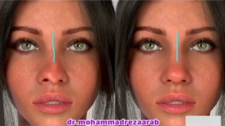 فیلم واقعی جراحی زیبایی بینی