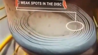 فیلم بیرون زدگی دیسک