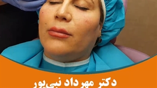رفع چروک پیشانی با تزریق فیلر