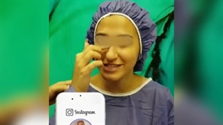 فیلم عمل زیبایی بینی