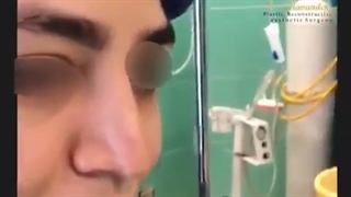 فیلم واقعی جراحى بینى نامتقارن️