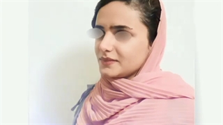 فیلم عمل بینی طبیعی دخترانه