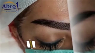 کاشت ابرو یا مداد ابرو؟ شما کدومو ترجیح میدین؟| کلینیک ابروان