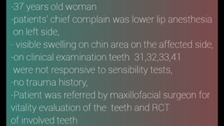 کیست و تومورهای فکی(Case presentation)