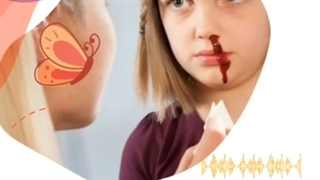 علت خونریزی بینی در کودکان