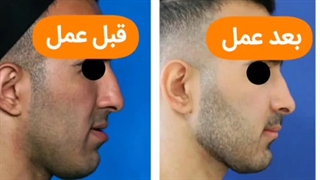 اصلاح روابط فکی دکتر مهدی سزاوار