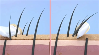 فواید اصلاح صورت با تیغ (شیو کردن موهای صورت)